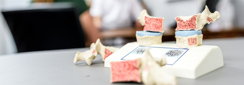 Orthopädie Bonn – Klippert, Mies, Sippel – Osteoporose Orthopädie Bonn - Klippert, Mies, Sippel - Osteoporose